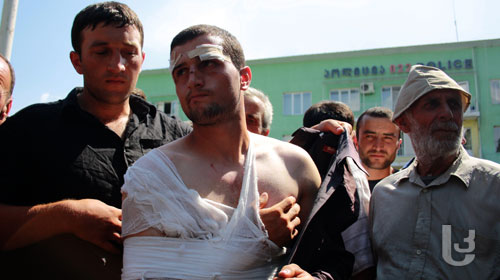 Injured during clashes with police (Samkhretis Karibche)